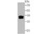 SET Nuclear Proto-Oncogene antibody, A02211-1, Boster Biological Technology, Western Blot image 