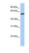 Zinc Finger Protein 284 antibody, NBP1-91368, Novus Biologicals, Western Blot image 