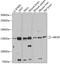 Huntingtin Interacting Protein 1 Related antibody, A05059, Boster Biological Technology, Western Blot image 