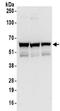 Zinc Finger Protein 622 antibody, NBP2-32102, Novus Biologicals, Western Blot image 