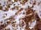 Alpha-Methylacyl-CoA Racemase antibody, LS-C791642, Lifespan Biosciences, Immunohistochemistry paraffin image 