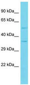 Platelet Derived Growth Factor C antibody, TA343168, Origene, Western Blot image 