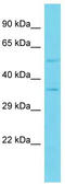 Platelet-derived growth factor C antibody, TA343168, Origene, Western Blot image 