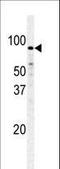 Phosphofructokinase, Muscle antibody, LS-C101265, Lifespan Biosciences, Western Blot image 