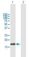 Phosphatidylinositol Glycan Anchor Biosynthesis Class H antibody, H00005283-B01P, Novus Biologicals, Western Blot image 