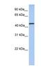 TRNA Methyltransferase 11 Homolog antibody, NBP1-52998, Novus Biologicals, Western Blot image 