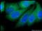 VPS28 Subunit Of ESCRT-I antibody, 15478-1-AP, Proteintech Group, Immunofluorescence image 