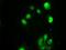 Checkpoint Kinase 2 antibody, NBP1-47695, Novus Biologicals, Immunocytochemistry image 