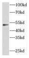 FOXP3 antibody, FNab03208, FineTest, Western Blot image 