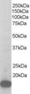 Actin Related Protein 2/3 Complex Subunit 3 antibody, GTX44635, GeneTex, Western Blot image 