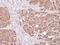 Dopamine Beta-Hydroxylase antibody, ab96615, Abcam, Immunohistochemistry paraffin image 