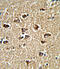 BicC Family RNA Binding Protein 1 antibody, abx033092, Abbexa, Immunohistochemistry paraffin image 