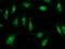 Fibroblast Growth Factor 21 antibody, LS-C785912, Lifespan Biosciences, Immunofluorescence image 