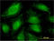 ATP-binding cassette sub-family F member 1 antibody, LS-C196593, Lifespan Biosciences, Immunofluorescence image 