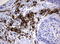 Fc Fragment Of IgG Receptor IIa antibody, LS-C796732, Lifespan Biosciences, Immunohistochemistry paraffin image 