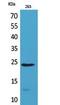 Interleukin 24 antibody, A03793, Boster Biological Technology, Western Blot image 