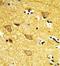 Inositol Polyphosphate-4-Phosphatase Type II B antibody, GTX80952, GeneTex, Immunohistochemistry paraffin image 