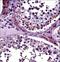 Protein Arginine Methyltransferase 5 antibody, LS-C162164, Lifespan Biosciences, Immunohistochemistry paraffin image 