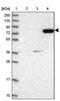 Terminal Nucleotidyltransferase 4B antibody, NBP2-48777, Novus Biologicals, Western Blot image 