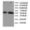 Cytochrome P450 Family 2 Subfamily E Member 1 antibody, orb97035, Biorbyt, Western Blot image 