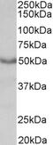 Voltage Dependent Anion Channel 2 antibody, 46-570, ProSci, Western Blot image 