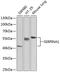 Alpha-1-antitrypsin antibody, GTX66005, GeneTex, Western Blot image 