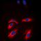 Creatine Kinase, M-Type antibody, orb213745, Biorbyt, Immunocytochemistry image 