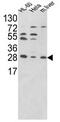 Proteasome Activator Subunit 2 antibody, AP17685PU-N, Origene, Western Blot image 