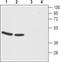 Cholecystokinin B Receptor antibody, TA328793, Origene, Western Blot image 