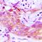 CKLF Like MARVEL Transmembrane Domain Containing 4 antibody, LS-C368889, Lifespan Biosciences, Immunohistochemistry paraffin image 