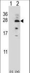 Interleukin 17B antibody, LS-C165176, Lifespan Biosciences, Western Blot image 