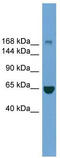 Terminal Uridylyl Transferase 4 antibody, TA344222, Origene, Western Blot image 