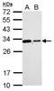 Charged Multivesicular Body Protein 2B antibody, PA5-31128, Invitrogen Antibodies, Western Blot image 