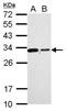 Charged multivesicular body protein 2b antibody, PA5-31128, Invitrogen Antibodies, Western Blot image 