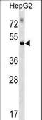 Rap Guanine Nucleotide Exchange Factor 5 antibody, LS-C162442, Lifespan Biosciences, Western Blot image 