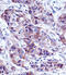 Lactalbumin Alpha antibody, abx028343, Abbexa, Immunohistochemistry paraffin image 
