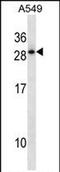 Homeobox D12 antibody, PA5-72149, Invitrogen Antibodies, Western Blot image 
