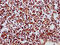 GATA Zinc Finger Domain Containing 2B antibody, LS-C680510, Lifespan Biosciences, Immunohistochemistry paraffin image 