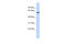 Zinc Finger Protein 207 antibody, 25-147, ProSci, Enzyme Linked Immunosorbent Assay image 