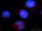 Checkpoint Kinase 1 antibody, 10362-1-AP, Proteintech Group, Immunofluorescence image 