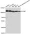 Cartilage Oligomeric Matrix Protein antibody, A5812, ABclonal Technology, Western Blot image 