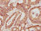 Matrix Metallopeptidase 3 antibody, LS-C285779, Lifespan Biosciences, Immunohistochemistry paraffin image 