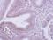 Coatomer Protein Complex Subunit Beta 1 antibody, PA5-29449, Invitrogen Antibodies, Immunohistochemistry paraffin image 