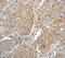 Egl-9 Family Hypoxia Inducible Factor 2 antibody, ab113077, Abcam, Immunohistochemistry paraffin image 