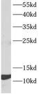 Mannosidase Beta Like antibody, FNab04967, FineTest, Western Blot image 