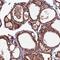 NEDD4 Binding Protein 1 antibody, NBP1-86233, Novus Biologicals, Immunohistochemistry frozen image 