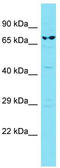 Cilia And Flagella Associated Protein 100 antibody, TA334871, Origene, Western Blot image 