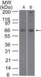 SUMO Specific Peptidase 2 antibody, TA336351, Origene, Western Blot image 