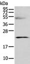 Complement C8 Gamma Chain antibody, PA5-51203, Invitrogen Antibodies, Western Blot image 