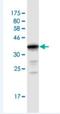 UDP Glucuronosyltransferase Family 2 Member B10 antibody, H00007365-M02, Novus Biologicals, Western Blot image 